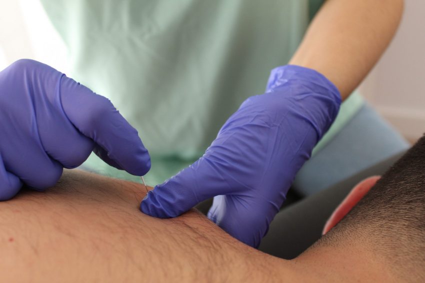 puncion-seca-almerimar-fisioterapia